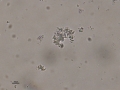 Particulate material
