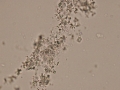 Particulate cellular debris