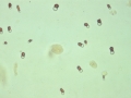 Bilirubin
