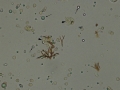 Bilirubin