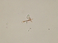 Bilirubin & sperm