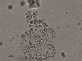 Calcium oxalate dihydrate