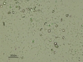 Calcium oxalate dihydrate