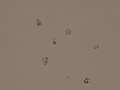Calcium carbonate