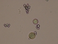 Calcium carbonate