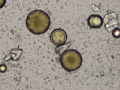 Calcium carbonate