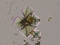 Calcium oxalate dihydrate