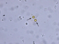 Ammonium biurate