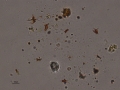 Bilirubin