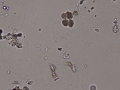 Ammonium biurate (cat)