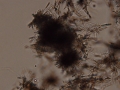 Ammonium biurate