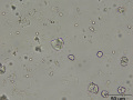 Starch crystals (wet prep)