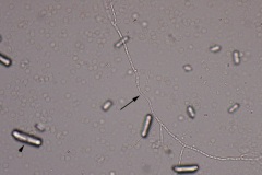 Urine infectious agents