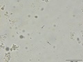 Streptococcus epidermidis