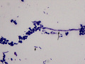 Yeast and bacteria (Wright's)