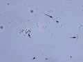Yeast and bacteria