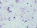 Cryptococcus