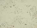 Cryptococcus