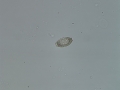 Capillaria