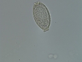 Capillaria