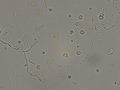 Bacilli & WBC