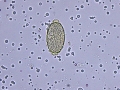 Capillaria