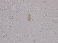 Capillaria