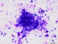 Streptococcus epidermidis (Wright's)