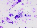 Streptococcus epidermidis (Wright's)
