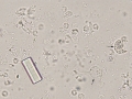Bacilli & WBC