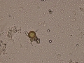 Cocci