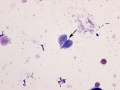 Giardia (Wright's)