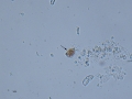 Isospora
