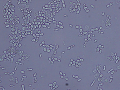 Yeast