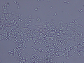 Yeast