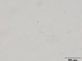 Yeast