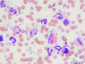Eosinophil compilation
