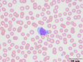 Lymphoma (dog)