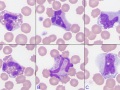 Eosinophils & basophils & monocytes