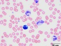 Mott-like cell & toxic change (dog)