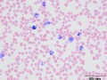 Mott-like cell & toxic change (dog)