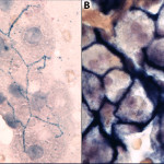 ALP cytochem liver