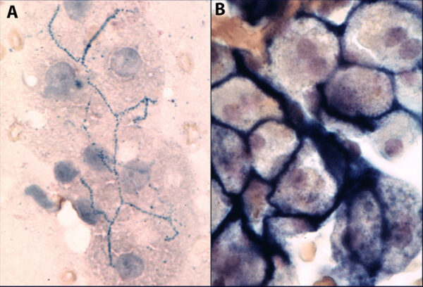 ALP cytochem liver