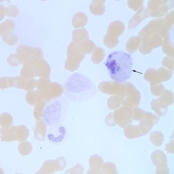 ALP promonocyte