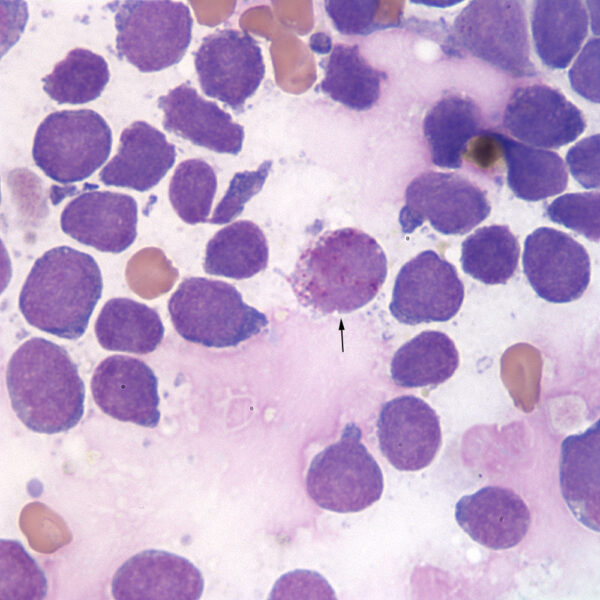 Granular blast