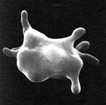 Acanthocyte seen with electron microscopy