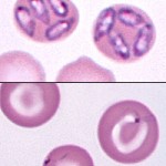 Babesia canis (upper) and Babesia gibsoni (lower) can be seen within erythrocytes