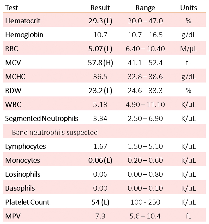 Monoclonal Gammopathy Archives Eclinpath 3900