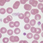 Platelets dispersed in the monolayer of a canine blood film. 