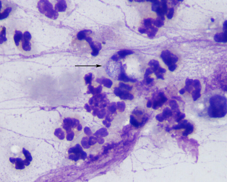 Degenerate neutrophils | eClinpath